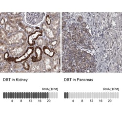 DBT Antibody, Novus Biologicals:Antibodies:Primary Antibodies